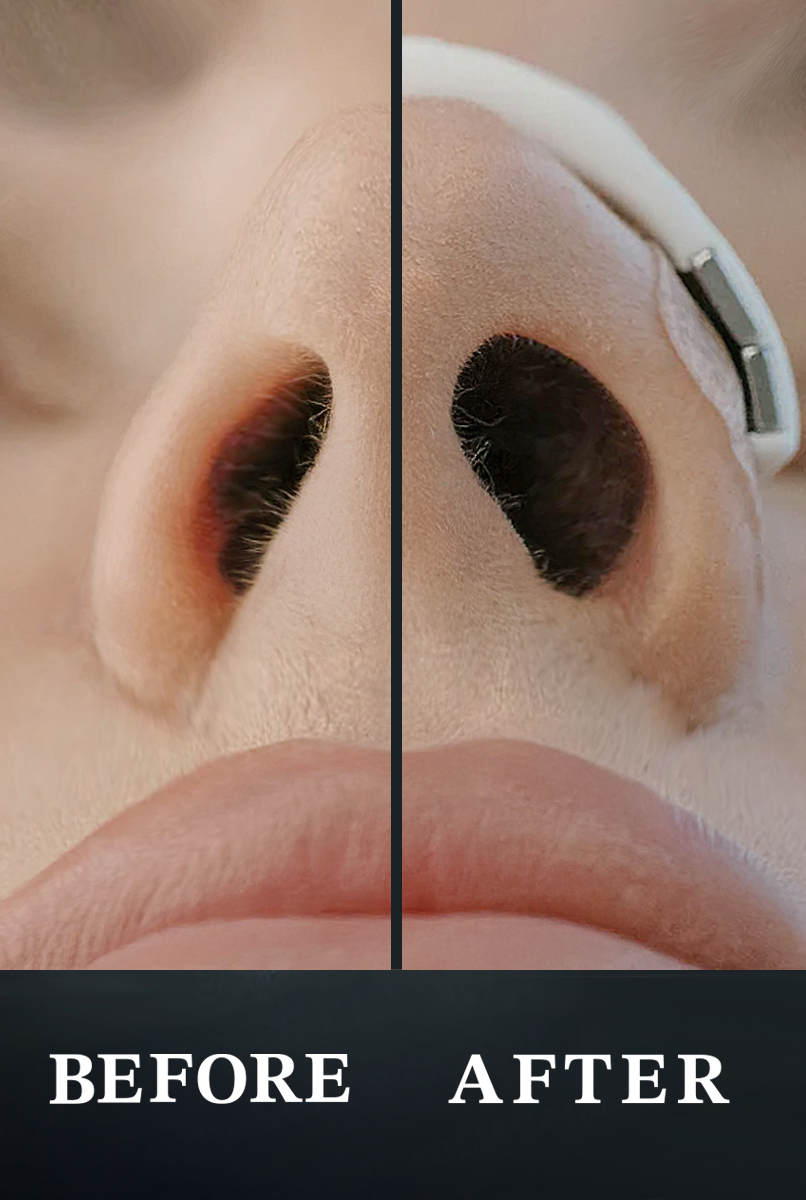 Magnetische Neusstrips - Sport & Sleep | Pearl White