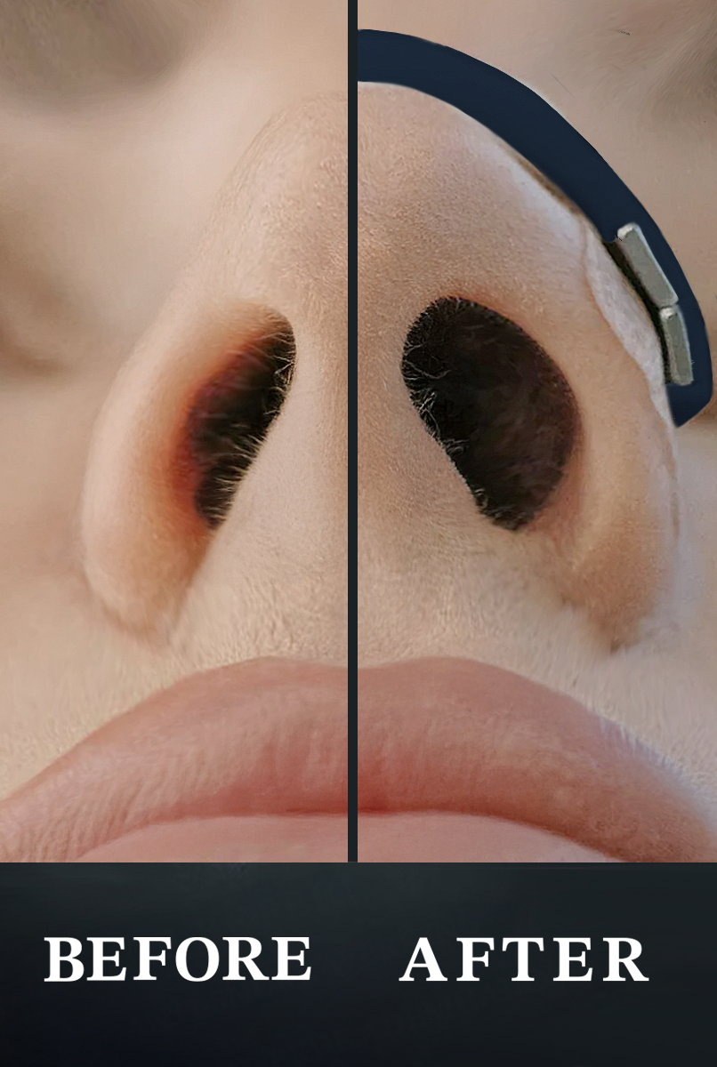 Magnetische Neusstrips - Sport & Sleep | Navy Blue